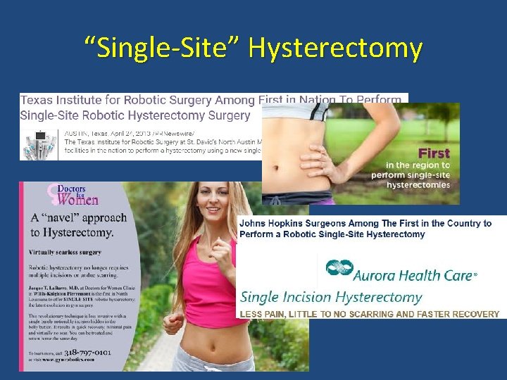 “Single-Site” Hysterectomy “Single-Site” Hysterectomy
