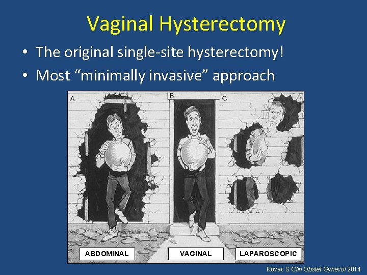 Vaginal Hysterectomy • The original single-site hysterectomy! • Most “minimally invasive” approach ABDOMINAL VAGINAL