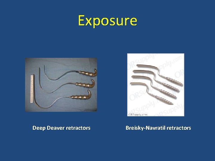 Exposure Deep Deaver retractors Breisky-Navratil retractors 
