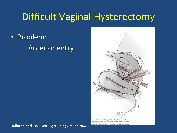 Difficult Vaginal Hysterectomy • Problem: Anterior entry Hoffman et al. Williams Gynecology 2 nd