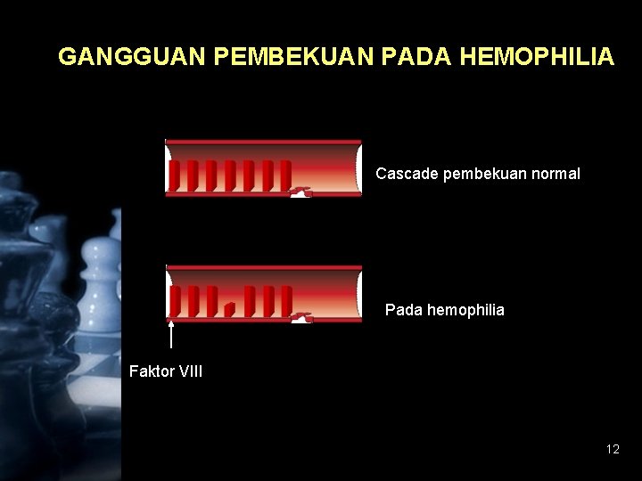 GANGGUAN PEMBEKUAN PADA HEMOPHILIA Cascade pembekuan normal Pada hemophilia Faktor VIII 12 