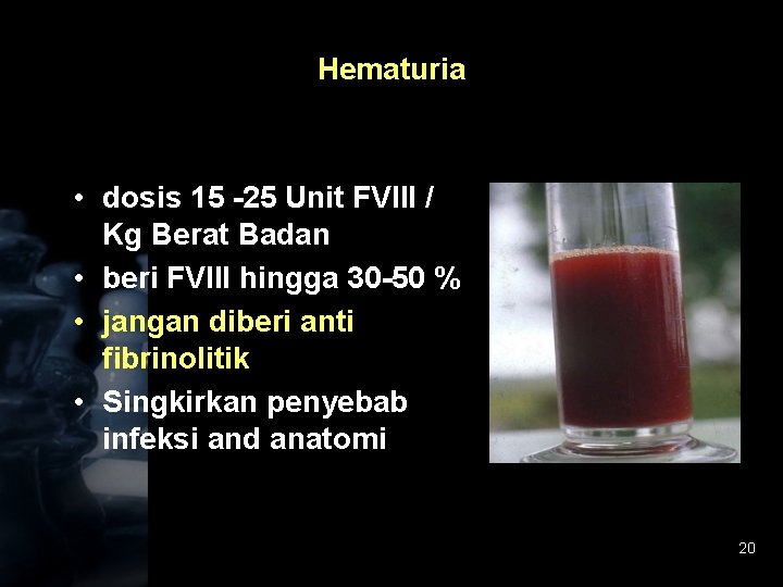 Hematuria • dosis 15 -25 Unit FVIII / Kg Berat Badan • beri FVIII