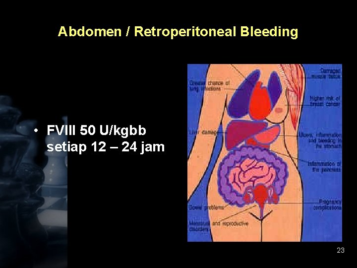 Abdomen / Retroperitoneal Bleeding • FVIII 50 U/kgbb setiap 12 – 24 jam 23