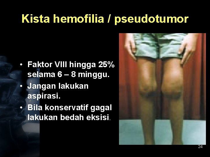 Kista hemofilia / pseudotumor • Faktor VIII hingga 25% selama 6 – 8 minggu.