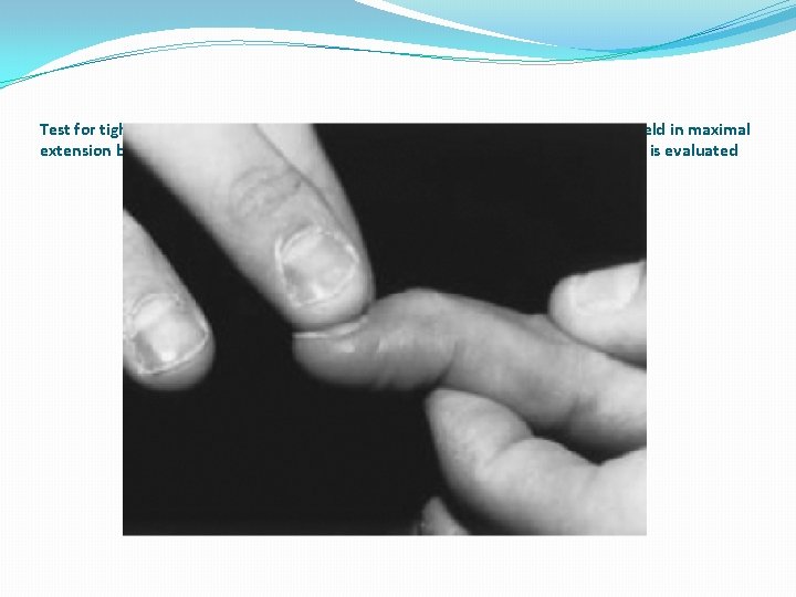Test for tightness of oblique retinacular ligament. Proximal interphalangeal joint held in maximal extension