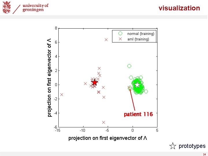 projection on first eigenvector of Λ visualization patient 116 projection on first eigenvector of
