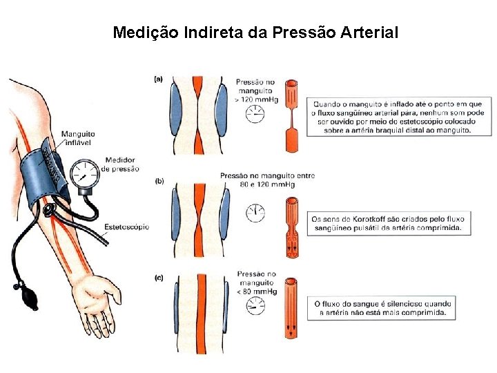 Medição Indireta da Pressão Arterial 