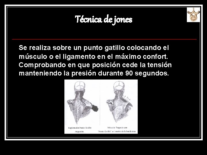 Técnica de jones Se realiza sobre un punto gatillo colocando el músculo o el