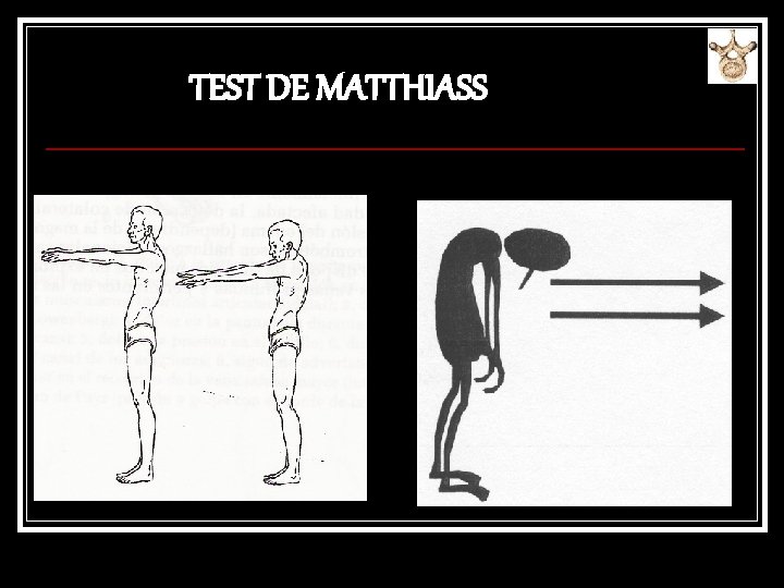 TEST DE MATTHIASS 