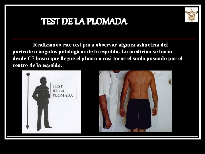 TEST DE LA PLOMADA Realizamos este test para observar alguna asimetría del paciente o