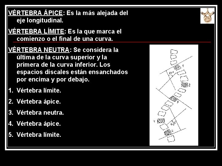 VÉRTEBRA ÁPICE: Es la más alejada del eje longitudinal. VÉRTEBRA LÍMITE: Es la que