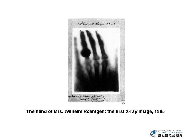 The hand of Mrs. Wilhelm Roentgen: the first X-ray image, 1895 