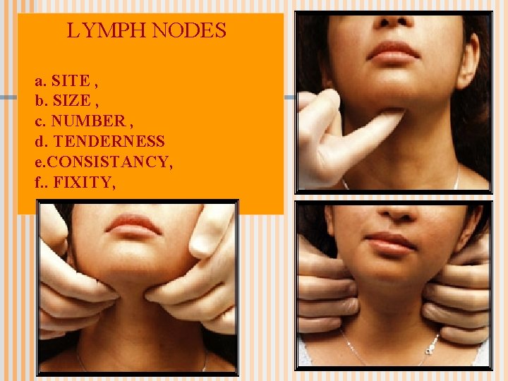 LYMPH NODES a. SITE , b. SIZE , c. NUMBER , d. TENDERNESS e.
