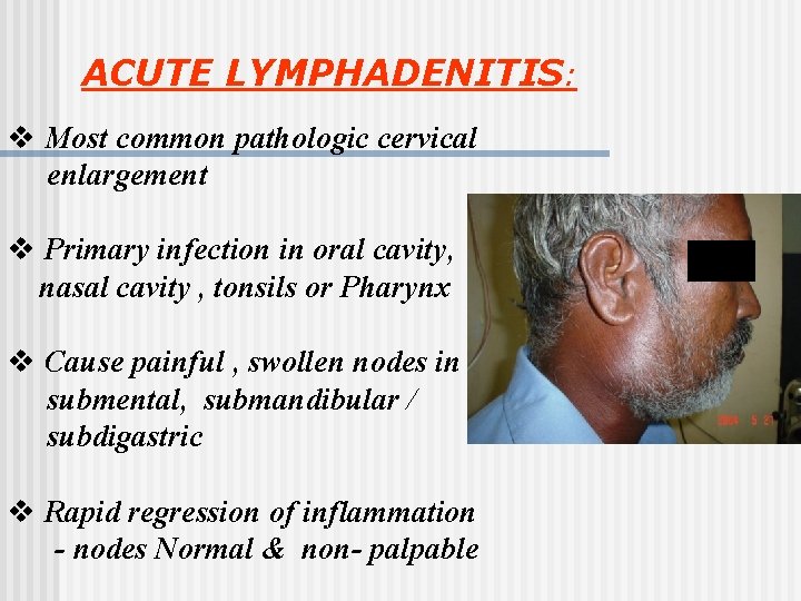 ACUTE LYMPHADENITIS: v Most common pathologic cervical enlargement v Primary infection in oral cavity,