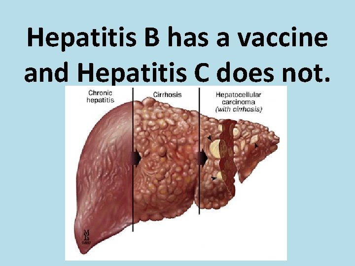 Hepatitis B has a vaccine and Hepatitis C does not. 