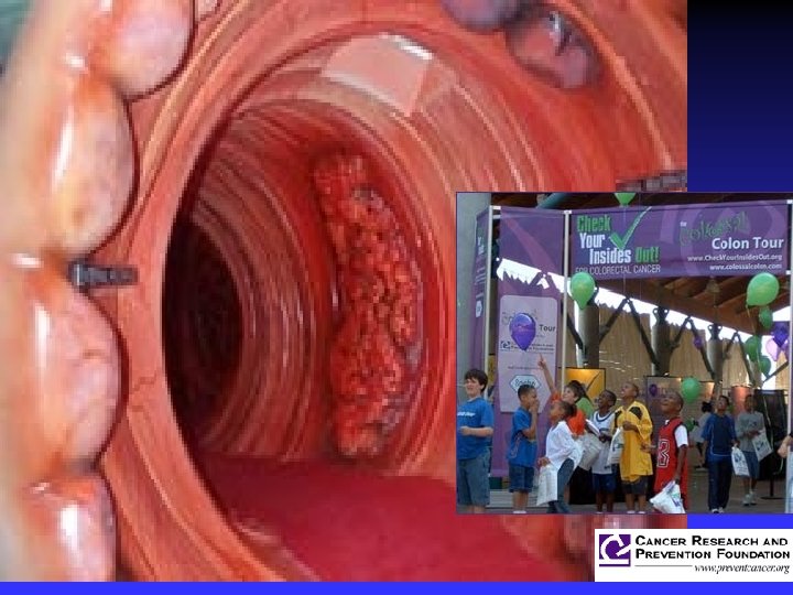  Click here to take a video tour of the Colossal Colon The Colossal