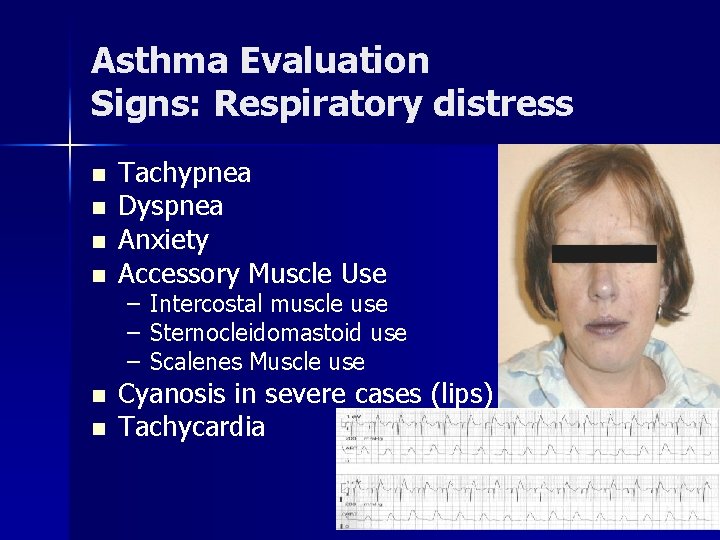Asthma Evaluation Signs: Respiratory distress n n n Tachypnea Dyspnea Anxiety Accessory Muscle Use