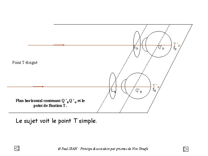 LD Q’D Point T éloigné LG Q’G Plan horizontal contenant Q ’DQ ’G et