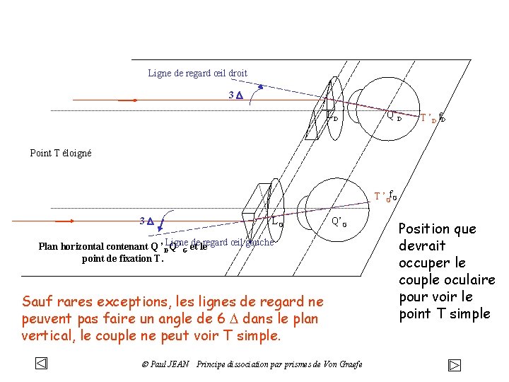 Ligne de regard œil droit 3 D LD Q’D T ’D f. D Point