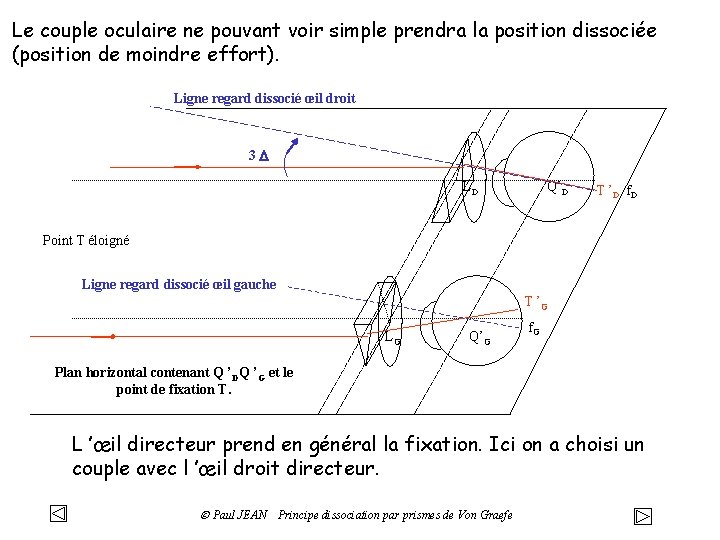 Le couple oculaire ne pouvant voir simple prendra la position dissociée (position de moindre