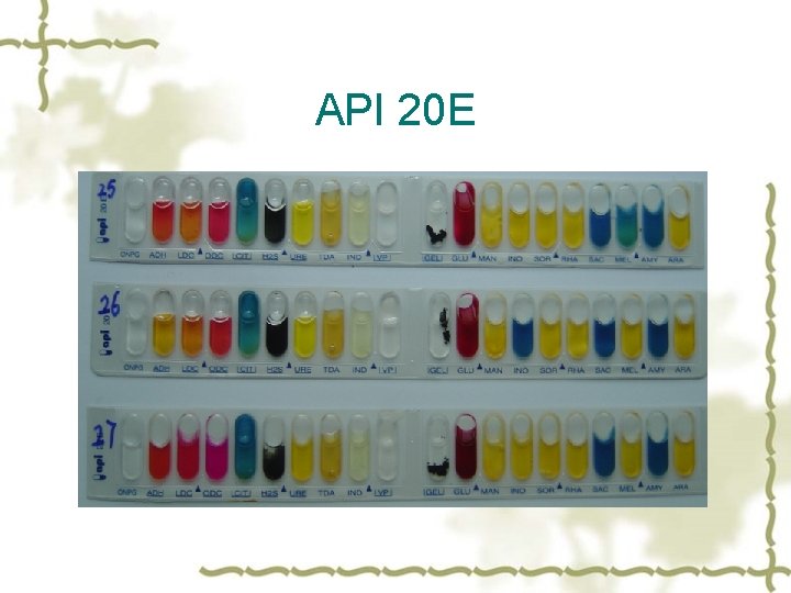 API 20 E 