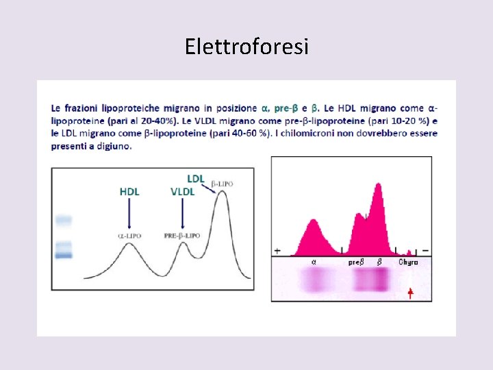 Elettroforesi 