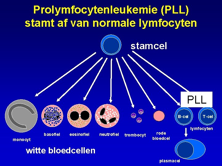 Prolymfocytenleukemie (PLL) stamt af van normale lymfocyten stamcel PLL B-cel basofiel eosinofiel monocyt neutrofiel
