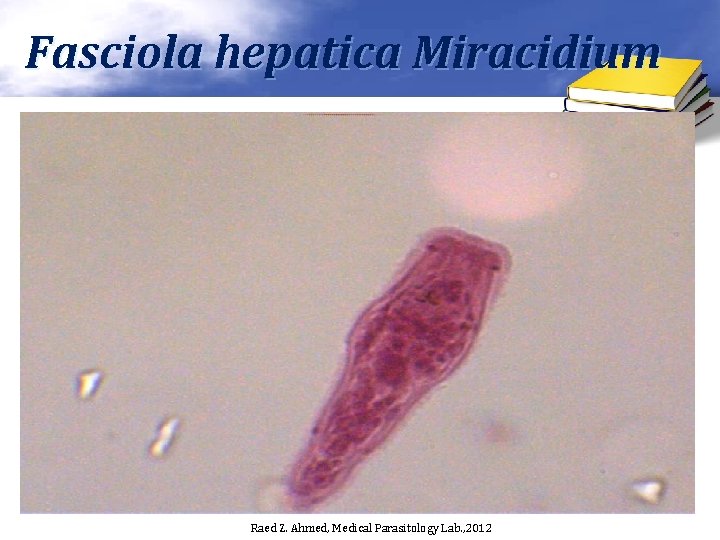 Fasciola hepatica Miracidium Raed Z. Ahmed, Medical Parasitology Lab. , 2012 