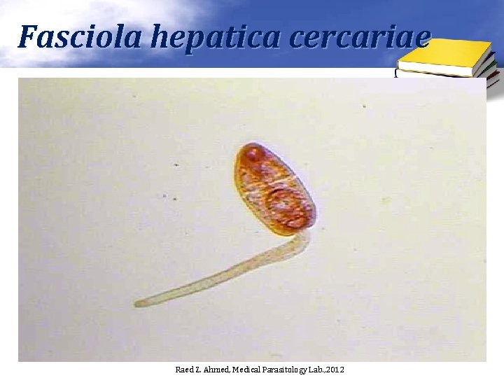 Fasciola hepatica cercariae Raed Z. Ahmed, Medical Parasitology Lab. , 2012 