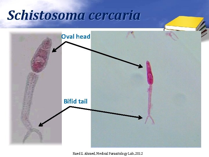 Schistosoma cercaria Oval head Bifid tail Raed Z. Ahmed, Medical Parasitology Lab. , 2012