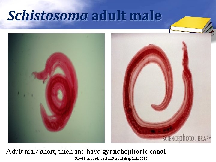 Schistosoma adult male Adult male short, thick and have gyanchophoric canal Raed Z. Ahmed,