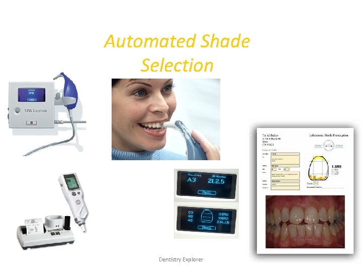 Automated Shade Selection Dentistry Explorer 