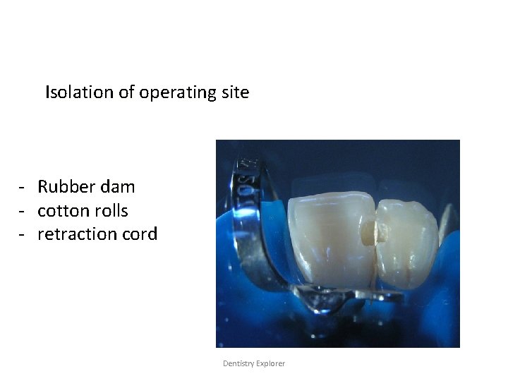Isolation of operating site - Rubber dam - cotton rolls - retraction cord Dentistry