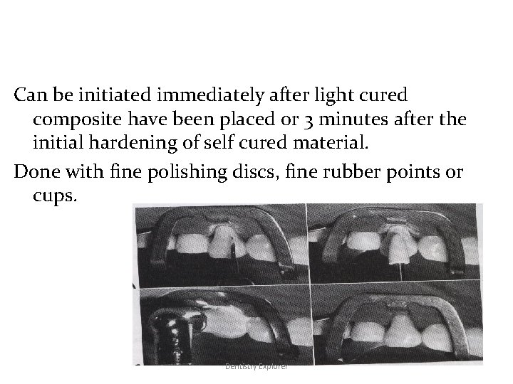 CONTOURINGCan be initiated immediately after light cured composite have been placed or 3 minutes