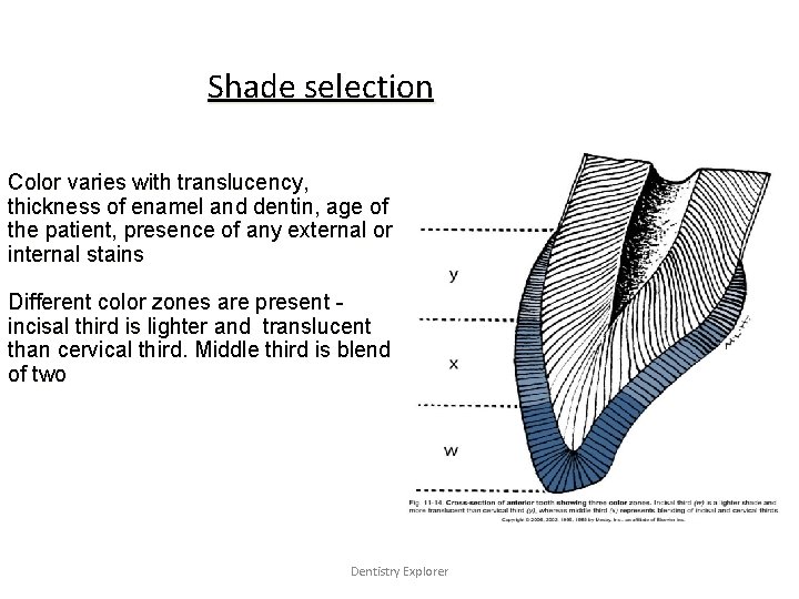 Shade selection Color varies with translucency, thickness of enamel and dentin, age of the