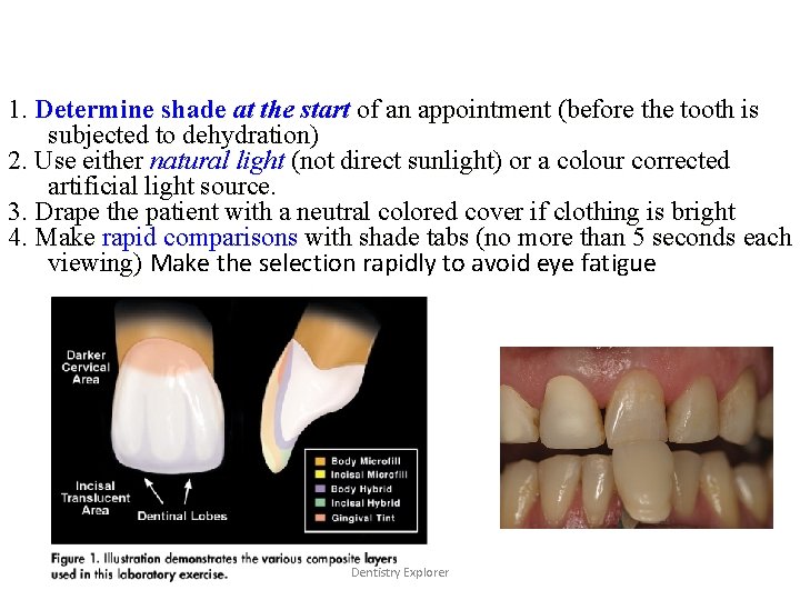 1. Determine shade at the start of an appointment (before the tooth is subjected