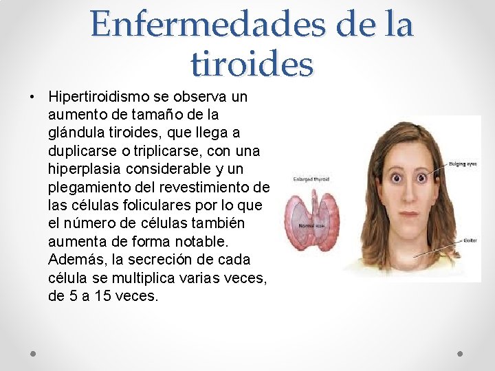 Enfermedades de la tiroides • Hipertiroidismo se observa un aumento de tamaño de la