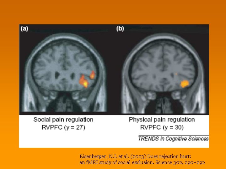 Eisenberger, N. I. et al. (2003) Does rejection hurt: an f. MRI study of