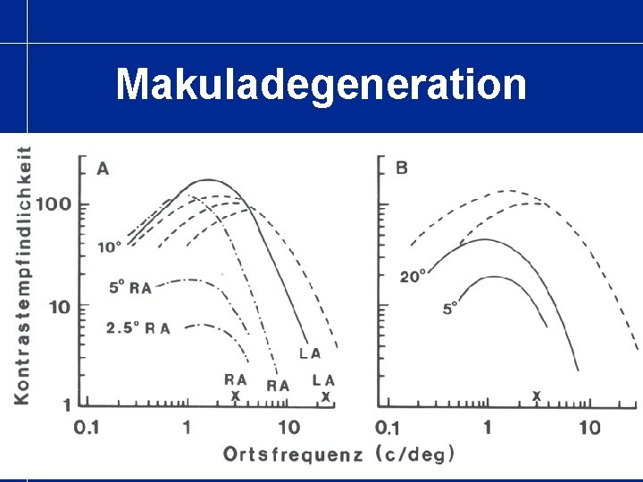 Makuladegeneration 