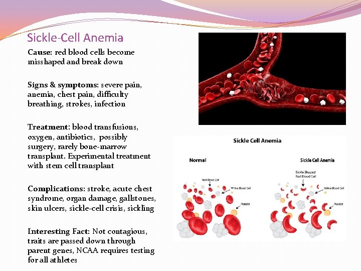 Sickle-Cell Anemia Cause: red blood cells become misshaped and break down Signs & symptoms: Sickle-Cell Anemia Cause: red blood cells become misshaped and break down Signs & symptoms: