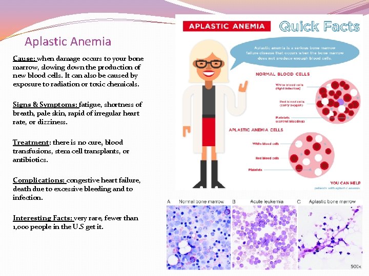 Aplastic Anemia Cause: when damage occurs to your bone marrow, slowing down the production Aplastic Anemia Cause: when damage occurs to your bone marrow, slowing down the production