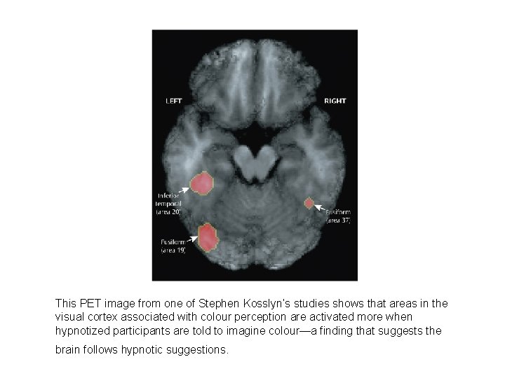 This PET image from one of Stephen Kosslyn’s studies shows that areas in the