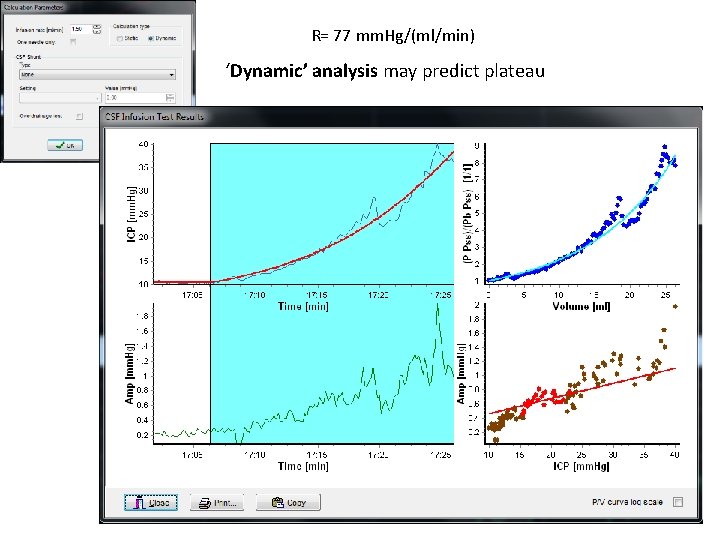 R= 77 mm. Hg/(ml/min) ‘Dynamic’ analysis may predict plateau 