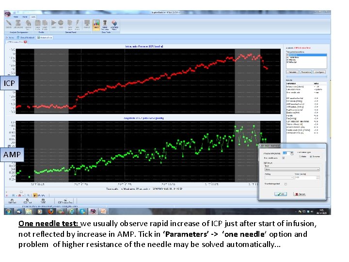 ICP AMP One needle test: we usually observe rapid increase of ICP just after