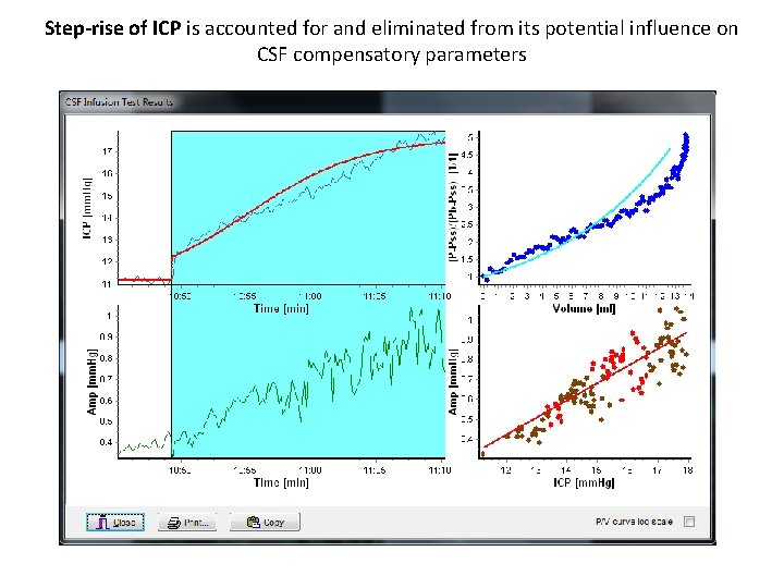 Step-rise of ICP is accounted for and eliminated from its potential influence on CSF