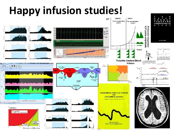 Happy infusion studies! 