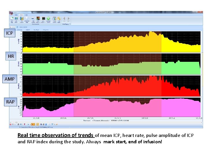 ICP HR AMP RAP Real time observation of trends of mean ICP, heart rate,