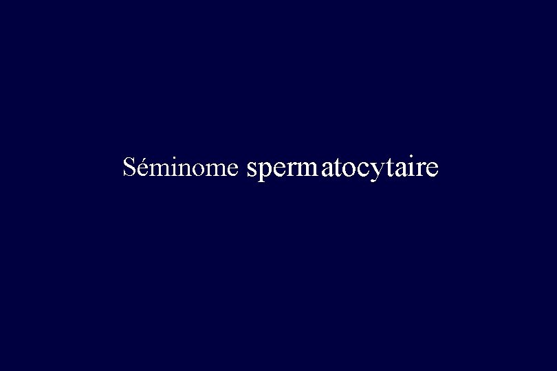 Séminome spermatocytaire 