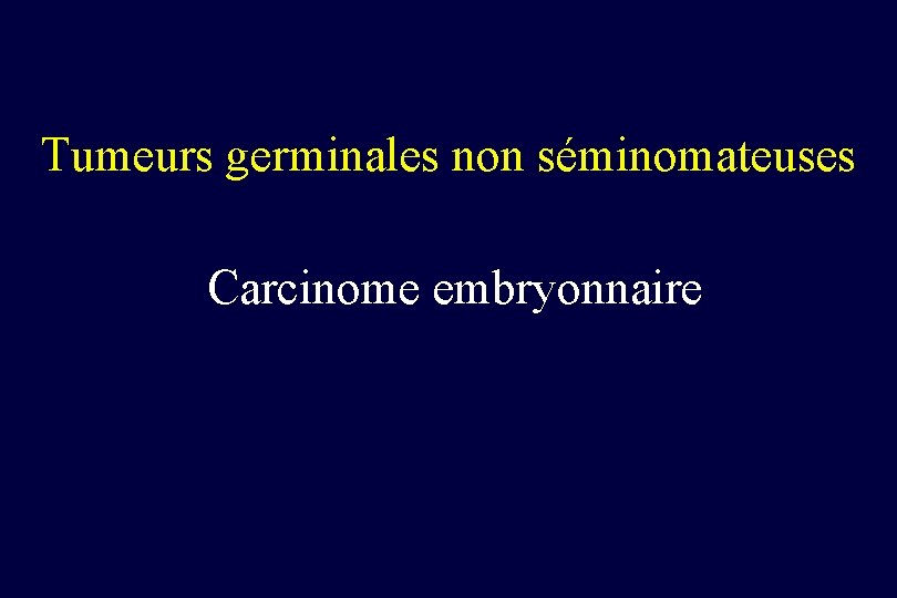 Tumeurs germinales non séminomateuses Carcinome embryonnaire 