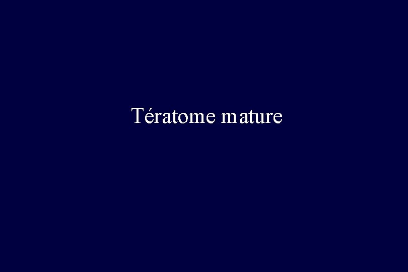 Tératome mature 